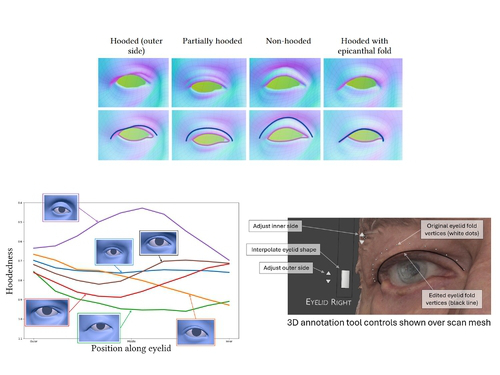 Eyelid Fold Consistency